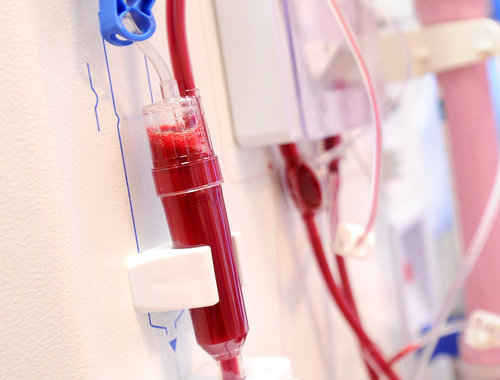 TRANSFUSION-jumbo-1-1
